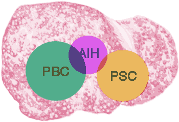  AIH und das Overlap-Syndrom