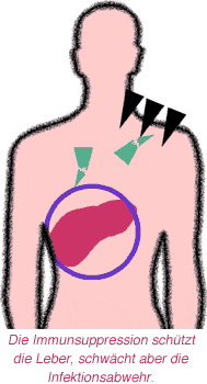Die Immunsuppression schützt die Leber, schwächt aber die Infektionsabwehr