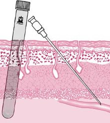 Schematische Darstellung Blutwertkontrolle
